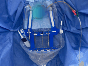 Rosenblatt Surgical Caddy