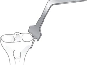 Wubben Lateral Fat Pad Retractor for TKR