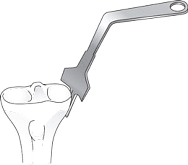 Wubben Lateral Fat Pad Retractor for TKR
